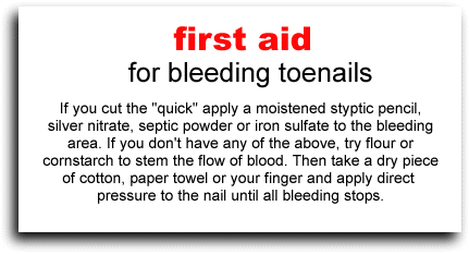 First Aid for Bleeding Nails - ladygouldianfinch.com